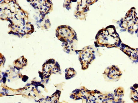 Immunohistochemistry (Formalin/PFA-fixed paraffin-embedded sections) - Anti-CD109 antibody (AB235896)