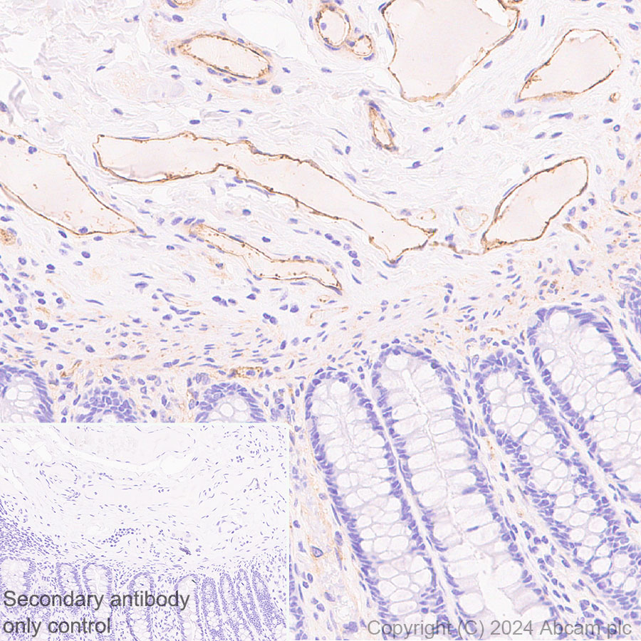 Immunohistochemistry (Formalin/PFA-fixed paraffin-embedded sections) - Anti-CD109 antibody [EPR29008-59] - BSA and Azide free (AB318143), expandable thumbnail