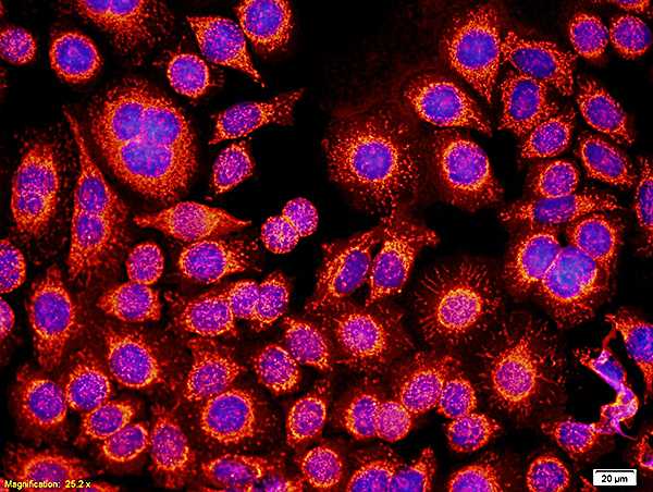 Immunocytochemistry/ Immunofluorescence - Anti-CD116 antibody (AB202851), expandable thumbnail