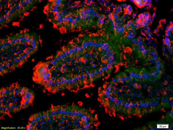 Immunohistochemistry (Formalin/PFA-fixed paraffin-embedded sections) - Anti-CD116 antibody (AB202851)