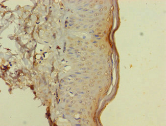 Immunohistochemistry (Formalin/PFA-fixed paraffin-embedded sections) - Anti-CD116 antibody (AB238104)