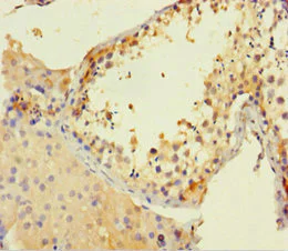 Immunohistochemistry (Formalin/PFA-fixed paraffin-embedded sections) - Anti-CD116 antibody (AB238104)