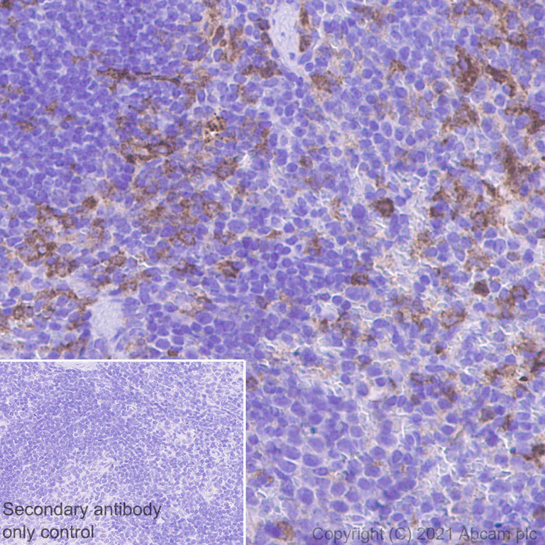 Immunohistochemistry (Formalin/PFA-fixed paraffin-embedded sections) - Anti-CD116 antibody [EPR24554-113] - BSA and Azide free (AB280372)