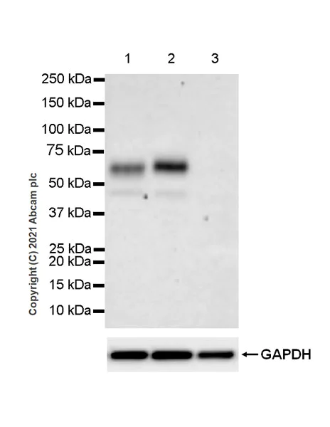 Western blot - Anti-CD116 antibody [EPR24554-113] - BSA and Azide free (AB280372)