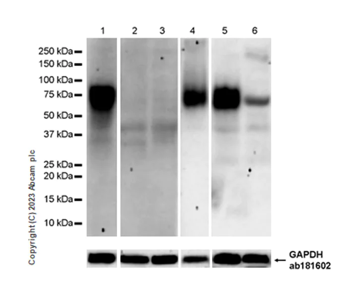 Western blot - Anti-CD116 antibody [EPR26505-444] (AB308294)