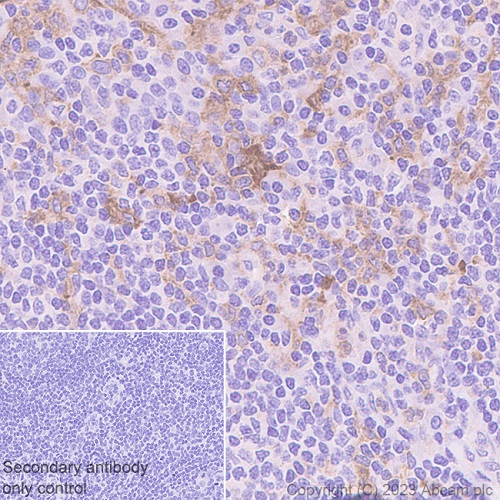 Immunohistochemistry (Formalin/PFA-fixed paraffin-embedded sections) - Anti-CD116 antibody [EPR26505-444] - BSA and Azide free (AB308295), expandable thumbnail