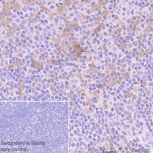 Immunohistochemistry (Formalin/PFA-fixed paraffin-embedded sections) - Anti-CD116 antibody [EPR26505-444] - BSA and Azide free (AB308295)