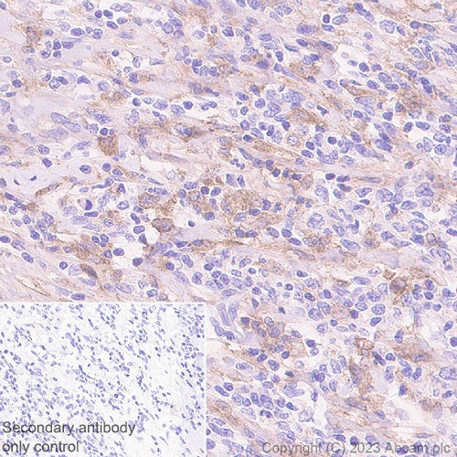 Immunohistochemistry (Formalin/PFA-fixed paraffin-embedded sections) - Anti-CD116 antibody [EPR26505-444] - BSA and Azide free (AB308295), expandable thumbnail