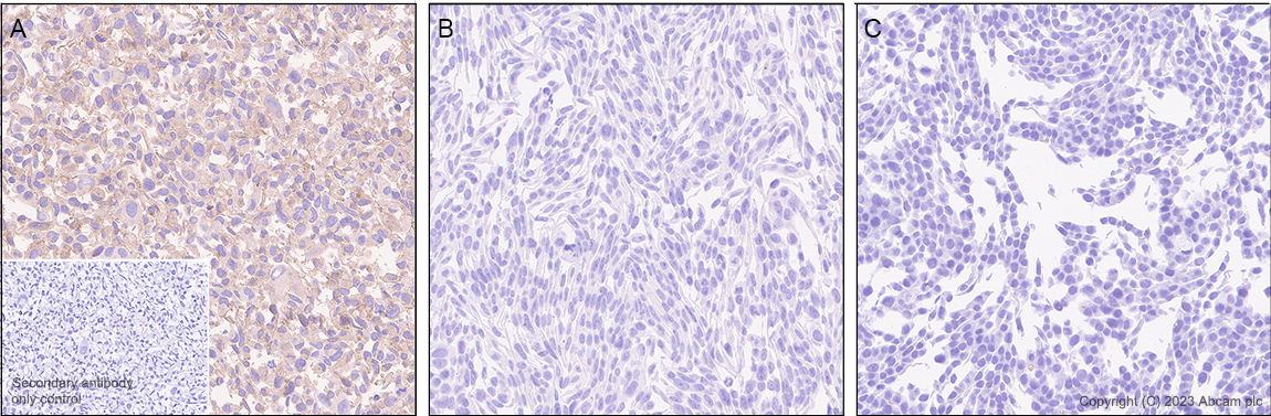 Immunohistochemistry (Formalin/PFA-fixed paraffin-embedded sections) - Anti-CD116 antibody [EPR26505-444] - BSA and Azide free (AB308295), expandable thumbnail
