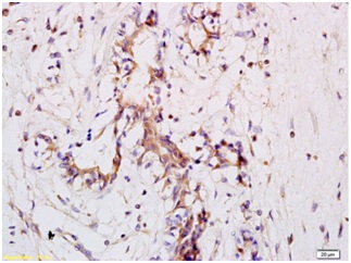 Immunohistochemistry (Formalin/PFA-fixed paraffin-embedded sections) - Anti-CD11a antibody (AB203336)