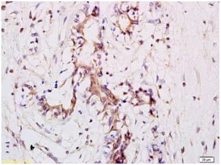 Immunohistochemistry (Formalin/PFA-fixed paraffin-embedded sections) - Anti-CD11a antibody (AB203336)