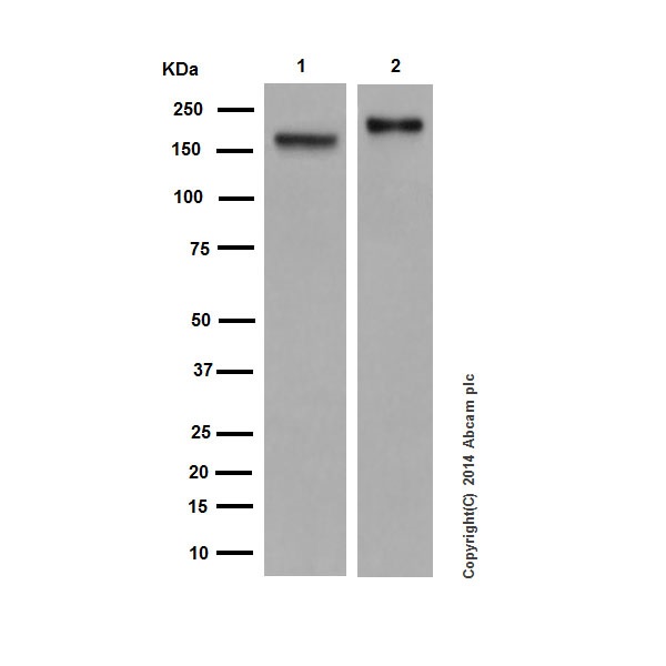 Western blot - Anti-CD11a antibody [EP1285Y] (AB52895), expandable thumbnail