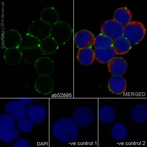 Immunocytochemistry/ Immunofluorescence - Anti-CD11a antibody [EP1285Y] - BSA and Azide free (AB227119)