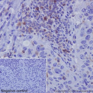 Immunohistochemistry (Formalin/PFA-fixed paraffin-embedded sections) - Anti-CD11a antibody [EP1285Y] - Low endotoxin, Azide free (AB246701), expandable thumbnail