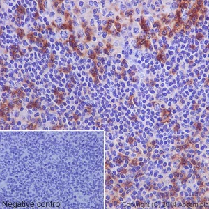 Immunohistochemistry (Formalin/PFA-fixed paraffin-embedded sections) - Anti-CD11a antibody [EP1285Y] - Low endotoxin, Azide free (AB246701), expandable thumbnail
