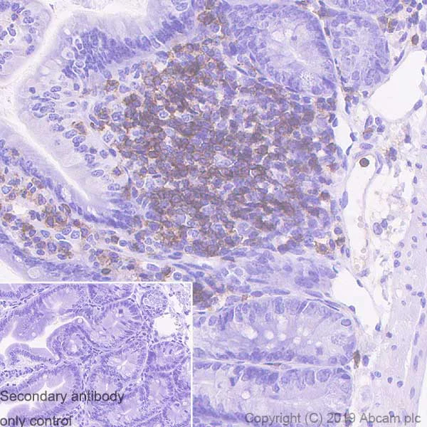 Immunohistochemistry (Formalin/PFA-fixed paraffin-embedded sections) - Anti-CD11a antibody [EPR22578-312] (AB228964)