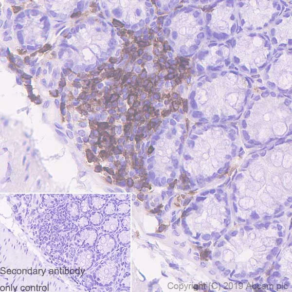 Immunohistochemistry (Formalin/PFA-fixed paraffin-embedded sections) - Anti-CD11a antibody [EPR22578-312] - BSA and Azide free (AB260001)