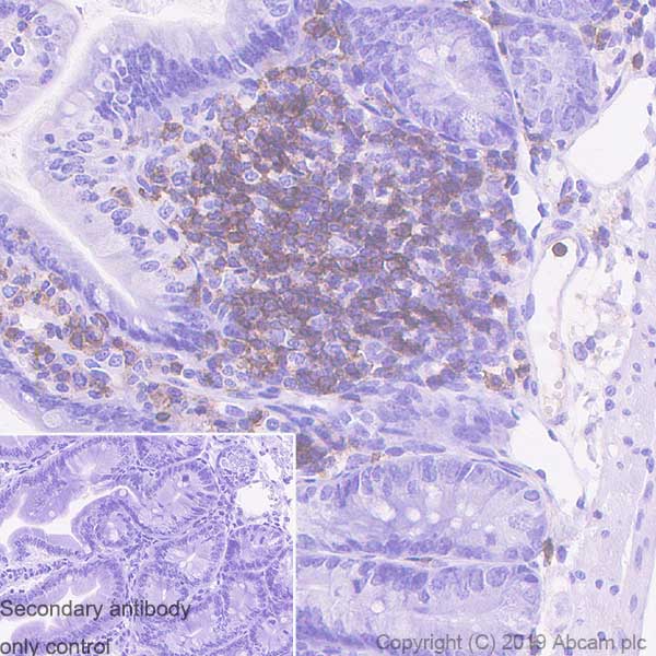 Immunohistochemistry (Formalin/PFA-fixed paraffin-embedded sections) - Anti-CD11a antibody [EPR22578-312] - BSA and Azide free (AB260001), expandable thumbnail