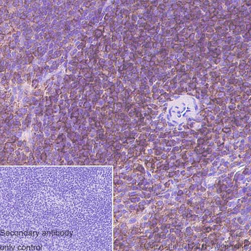 Immunohistochemistry (Formalin/PFA-fixed paraffin-embedded sections) - Anti-CD11a antibody [EPR22578-312] - BSA and Azide free (AB260001), expandable thumbnail