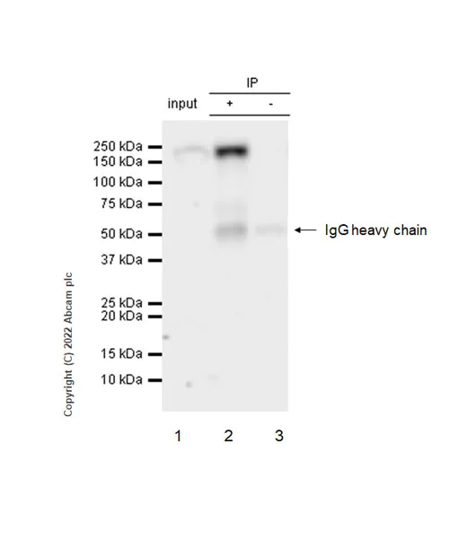 Immunoprecipitation - Anti-CD11a antibody [EPR26928-111A] (AB307658)