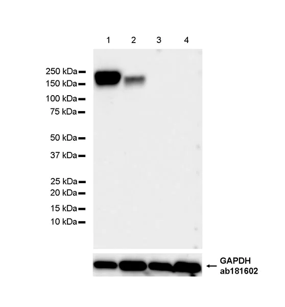 Western blot - Anti-CD11a antibody [EPR26928-111A] - BSA and Azide free (AB307659)