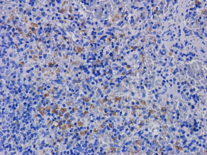 Immunohistochemistry (Formalin/PFA-fixed paraffin-embedded sections) - Anti-CD11a antibody [hu1124 (Efalizumab)] - Rabbit IgG (Chimeric) (AB275978)