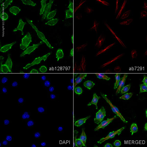 Immunocytochemistry - Anti-CD11b antibody (AB128797)