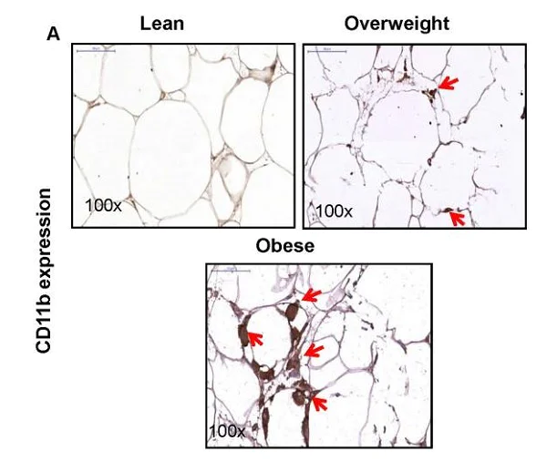 Immunohistochemistry (Formalin/PFA-fixed paraffin-embedded sections) - Anti-CD11b antibody [EP1345Y] - BSA and Azide free (AB187537)