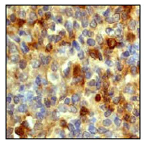 Immunohistochemistry (Formalin/PFA-fixed paraffin-embedded sections) - Anti-CD11b antibody [EP1345Y] - BSA and Azide free (AB187537)