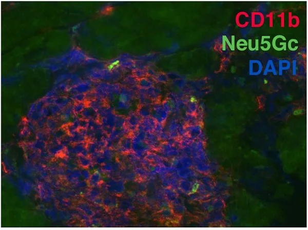Immunohistochemistry (Formalin/PFA-fixed paraffin-embedded sections) - Anti-CD11b antibody [EP1345Y] - BSA and Azide free (AB187537)