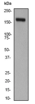 Western blot - Anti-CD11b antibody [EP1345Y] - C-terminal (AB52478)