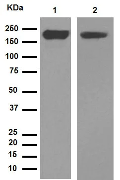 Western blot - Anti-CD11b antibody [EPR1344] (AB133357)