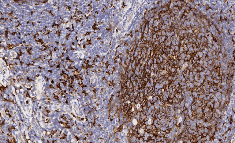 Immunohistochemistry (Formalin/PFA-fixed paraffin-embedded sections) - Anti-CD11b antibody [EPR1344] - Low endotoxin, Azide free (AB216445)