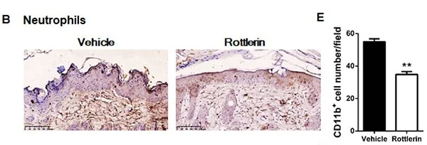 Immunohistochemistry (Formalin/PFA-fixed paraffin-embedded sections) - Anti-CD11b antibody [EPR1344] - Low endotoxin, Azide free (AB216445)