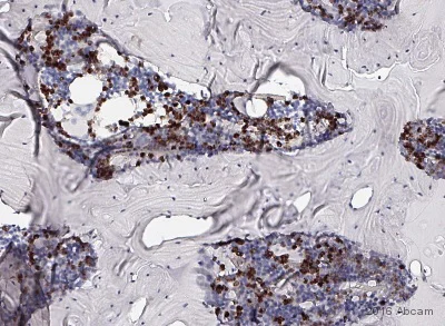 Immunohistochemistry (Formalin/PFA-fixed paraffin-embedded sections) - Anti-CD11b antibody [EPR1344] - Low endotoxin, Azide free (AB216445)