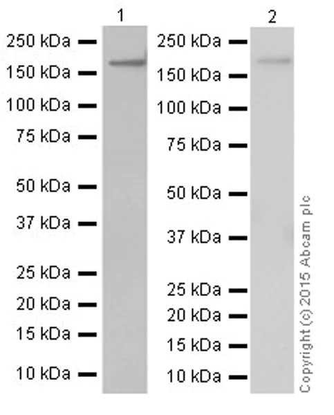 Western blot - Anti-CD11b antibody [EPR19373] (AB184307)