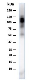 Western blot - Anti-CD11b antibody [ITGAM/3338] (AB269676), expandable thumbnail