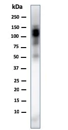 Western blot - Anti-CD11b antibody [ITGAM/3338] (AB269676)