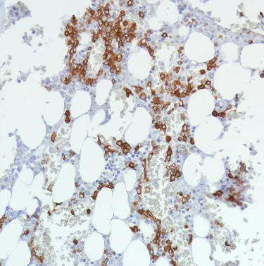 Immunohistochemistry (Formalin/PFA-fixed paraffin-embedded sections) - Anti-CD11b antibody [SP330] - BSA and Azide free (AB241408)