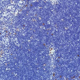 Immunohistochemistry (Formalin/PFA-fixed paraffin-embedded sections) - Anti-CD11b antibody [SP330] - BSA and Azide free (AB241408)