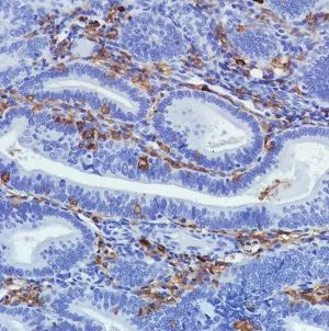 Immunohistochemistry (Formalin/PFA-fixed paraffin-embedded sections) - Anti-CD11b antibody [SP330] - BSA and Azide free (AB241408)