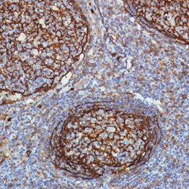 Immunohistochemistry (Formalin/PFA-fixed paraffin-embedded sections) - Anti-CD11b antibody [SP330] - BSA and Azide free (AB241408)