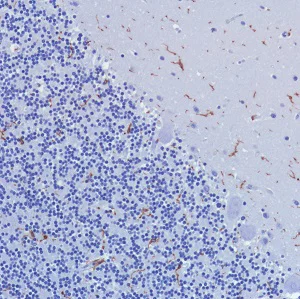 Immunohistochemistry (Formalin/PFA-fixed paraffin-embedded sections) - Anti-CD11b antibody [SP330] - BSA and Azide free (AB241408)