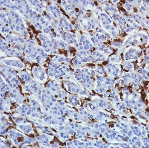 Immunohistochemistry (Formalin/PFA-fixed paraffin-embedded sections) - Anti-CD11b antibody [SP330] - BSA and Azide free (AB241408)