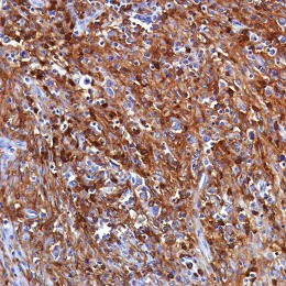 Immunohistochemistry (Formalin/PFA-fixed paraffin-embedded sections) - Anti-CD11b antibody [SP330] - BSA and Azide free (AB241408)