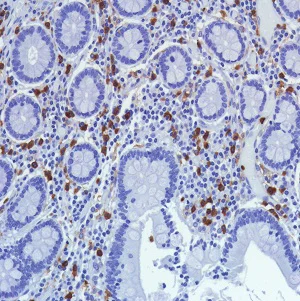 Immunohistochemistry (Formalin/PFA-fixed paraffin-embedded sections) - Anti-CD11b antibody [SP330] - BSA and Azide free (AB241408)