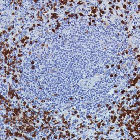 Immunohistochemistry (Formalin/PFA-fixed paraffin-embedded sections) - Anti-CD11b antibody [SP330] - BSA and Azide free (AB241408)