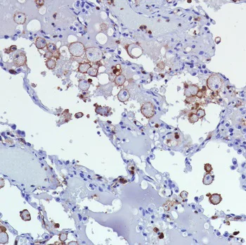 Immunohistochemistry (Formalin/PFA-fixed paraffin-embedded sections) - Anti-CD11b antibody [SP330] - BSA and Azide free (AB241408)