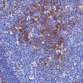 Immunohistochemistry (Formalin/PFA-fixed paraffin-embedded sections) - Anti-CD11b antibody [SP330] - C-terminal (AB224805)