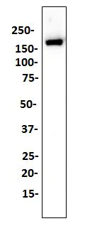 Western blot - Anti-CD11b antibody [SP330] - C-terminal (AB224805)